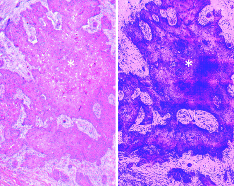 conventional histopathology vs. colorized confocal image